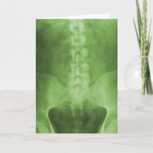 Grüne Digital-Röntgenstrahl-Kunst-Gruß-Karte Karte