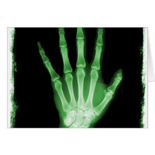 Grüne Röntgenstrahl-Skelett-Hand
