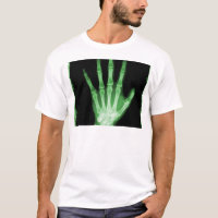 Grüne Röntgenstrahl-Skelett-Hand