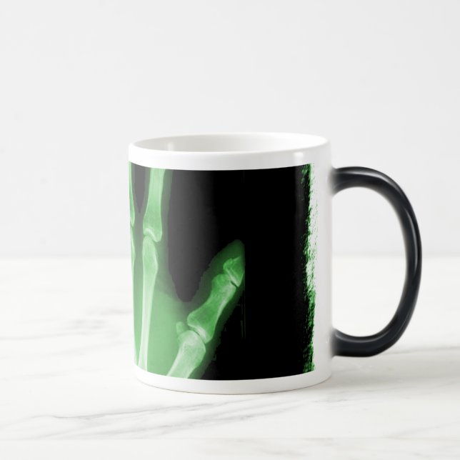 Grüne Röntgenstrahl-Skelett-Hand Verwandlungstasse (Rechts)