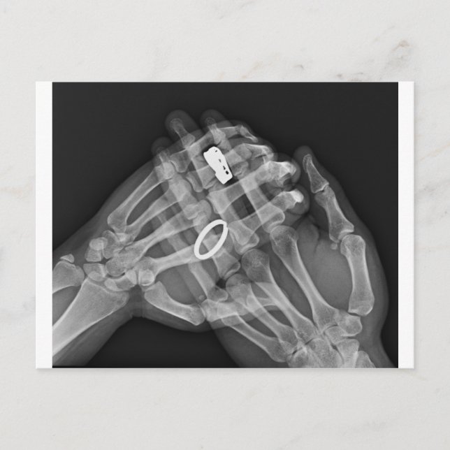 Handhaltung Postkarte (Vorderseite)