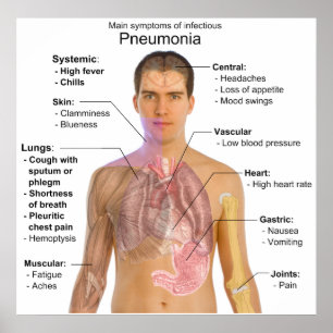 Hauptsymptome des ansteckenden Pneumonie-Diagramms Poster