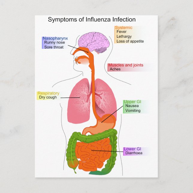 Hauptsymptome eines Influenza-Infektionsdiagramms Postkarte (Vorderseite)
