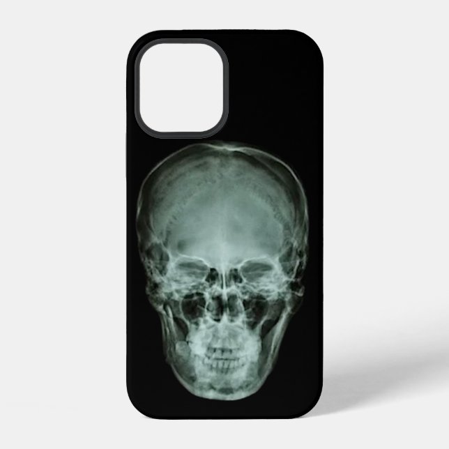 Head Skull X-Ray iPhone 12 Hülle (Rückseite)