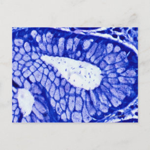Helicobacter Pylori Postkarte
