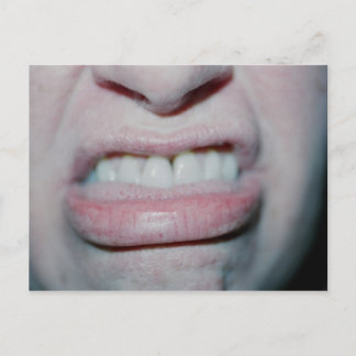 Heute kein Lächeln Postkarte