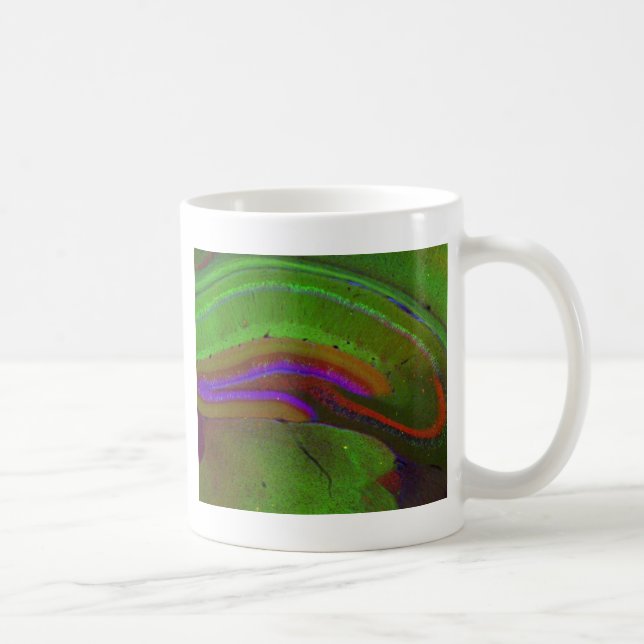 Hippocampal Neuronen Kaffeetasse (Rechts)