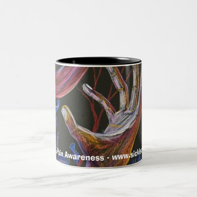 Hoffnung - Sichel-Zellen-Kunst Zweifarbige Tasse (Mittel)