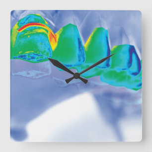 Horloge Carrée Original Teeth Design Dentist Wall Clock