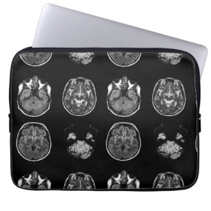Housse Pour Ordinateur Portable Analyse IRM du cerveau