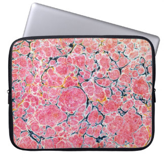 Housse Pour Ordinateur Portable Couverture en papier marbré victorien coloré