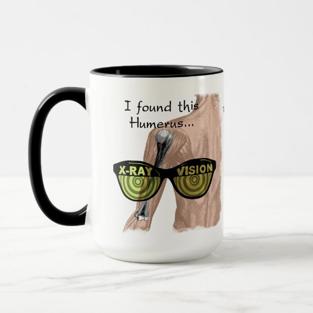 Humurer Humerus Funny Medical Personalisiert Tasse (Links)