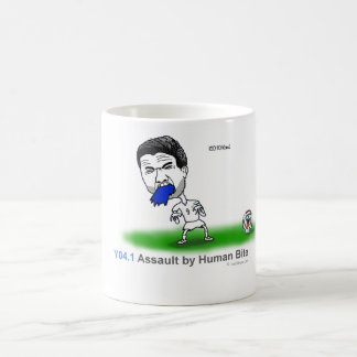 ICD-10: Angriff Y04.1 durch menschlichen Biss Kaffeetasse
