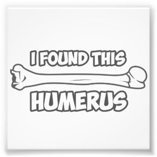 Ich fand diesen Humerus Fotodruck