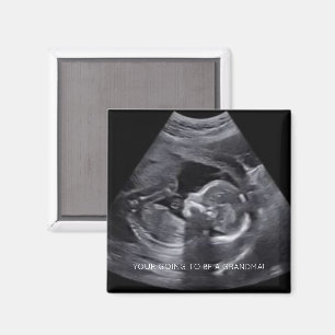Ihr werdet ein GRANDMA schwanges Sonogramm-FOTO se Magnet