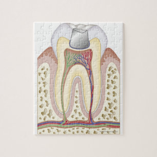 Illustration der zahnmedizinischen Füllung