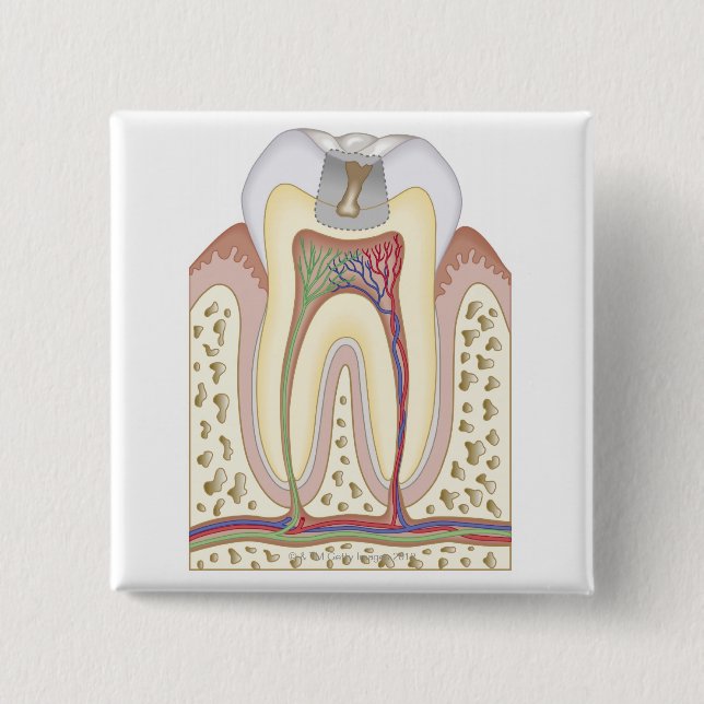 Illustration des Zahn-Zerfalls Button (Vorderseite)