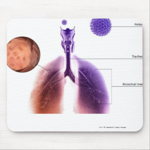 Illustration eines Asthmaanfalls vom Blütenstaub Mousepad