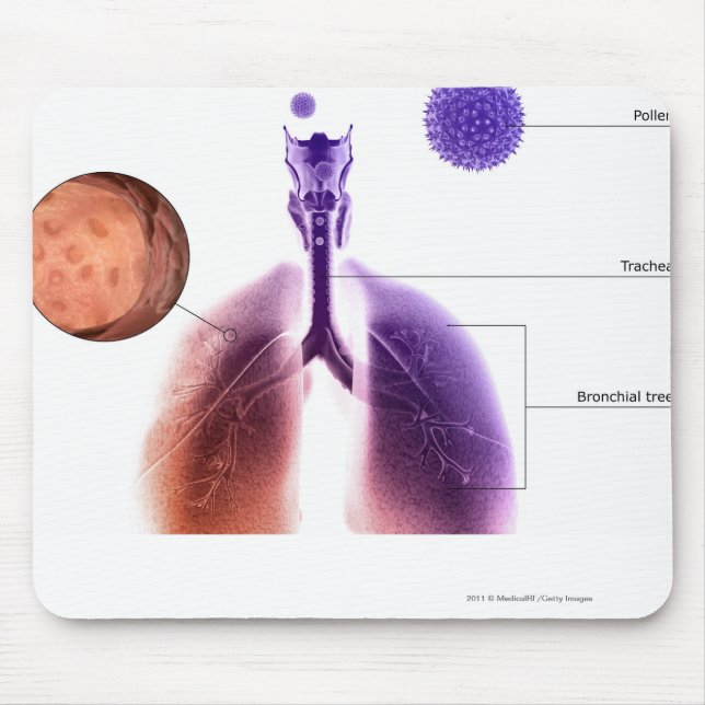 Illustration eines Asthmaanfalls vom Blütenstaub Mousepad (Vorne)