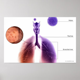 Illustration eines Asthmaanfalls vom Blütenstaub Poster
