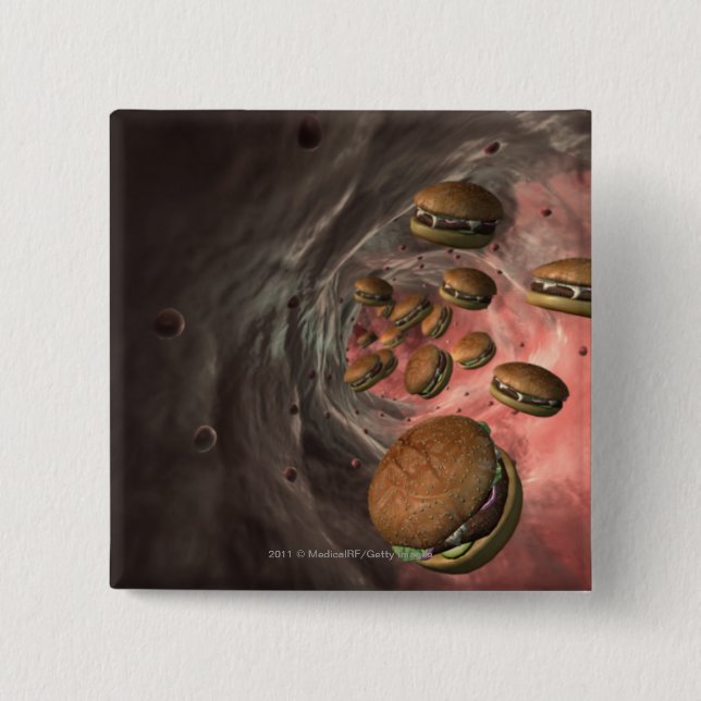 Illustration eines Blutgefäßes mit Burgern Button (Vorderseite)