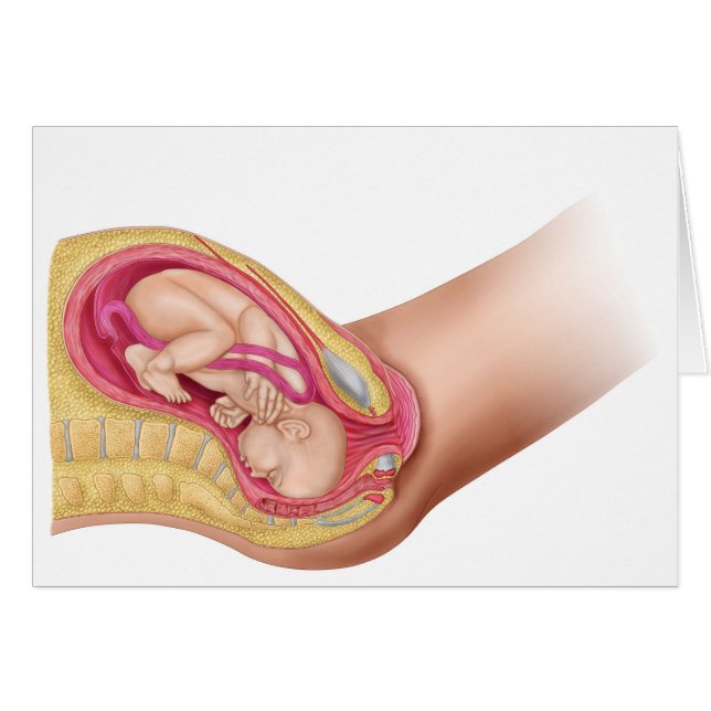 Illustration Montrant La Livraison Du Foetus 2 (Devant horizontal)