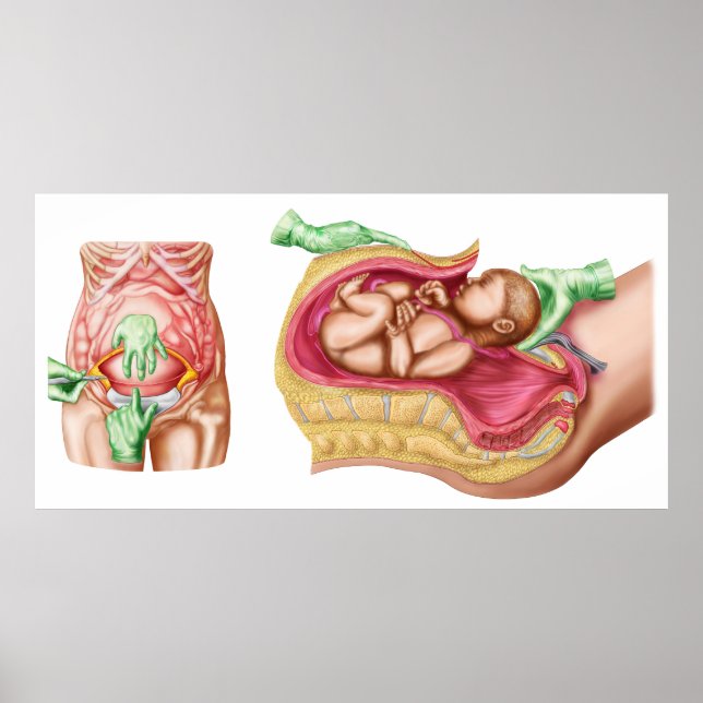 Illustration zur Darstellung der Lieferung von Föt Poster (Vorne)