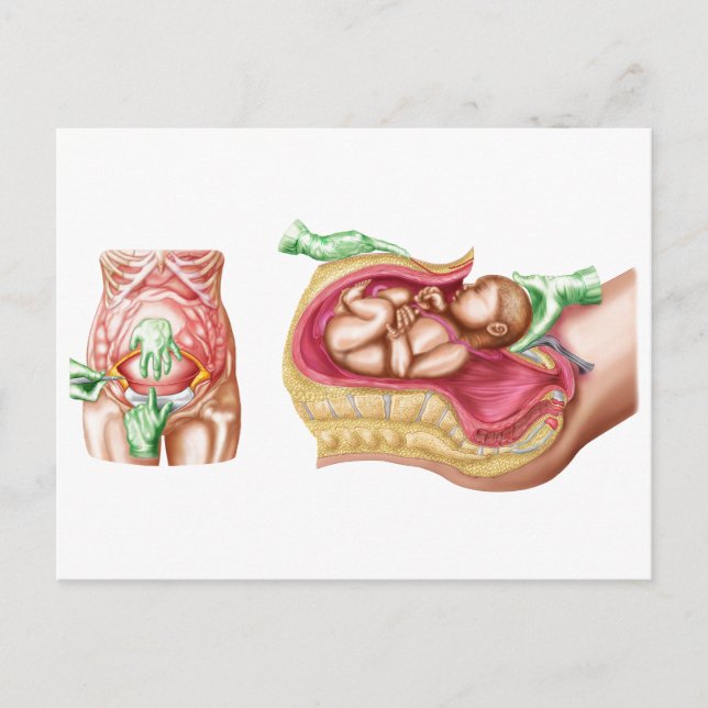 Illustration zur Darstellung der Lieferung von Föt Postkarte (Vorderseite)