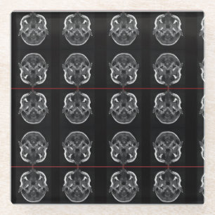 im Kopf xray mri scannen medizinisch Glasuntersetzer