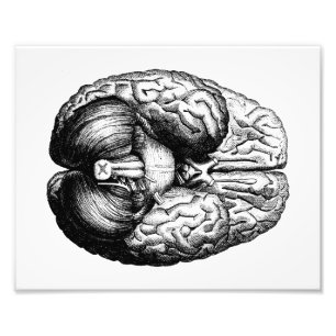 Impression Photo Cerveau anatomique