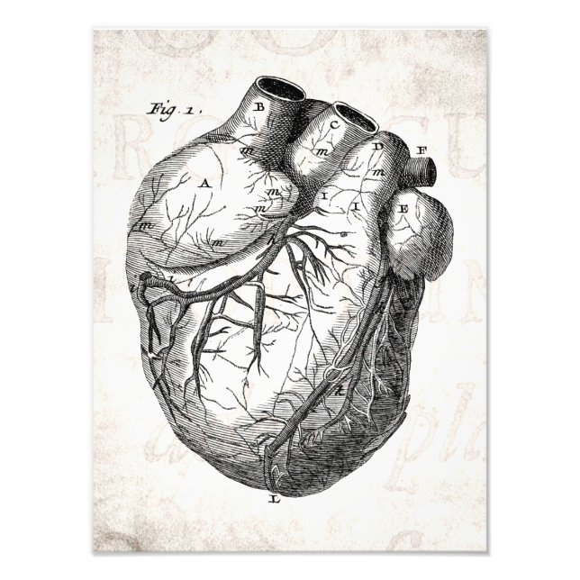 Impression Photo Coeurs cardiaques rétro Cardiac des années 1800 vi (Devant)