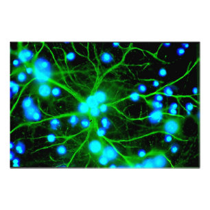 Impression Photo Les Astrocytes sont des cellules globulaires en fo