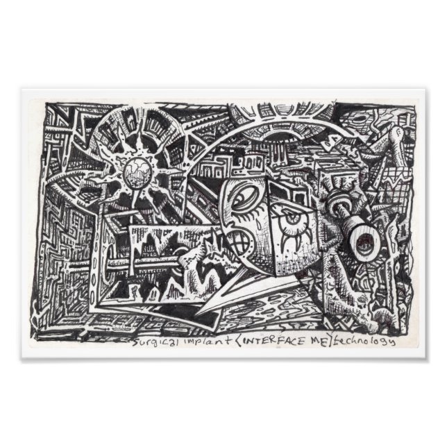 Impression Photo Technologie Implant chirurgical (Interface Me) (Devant)