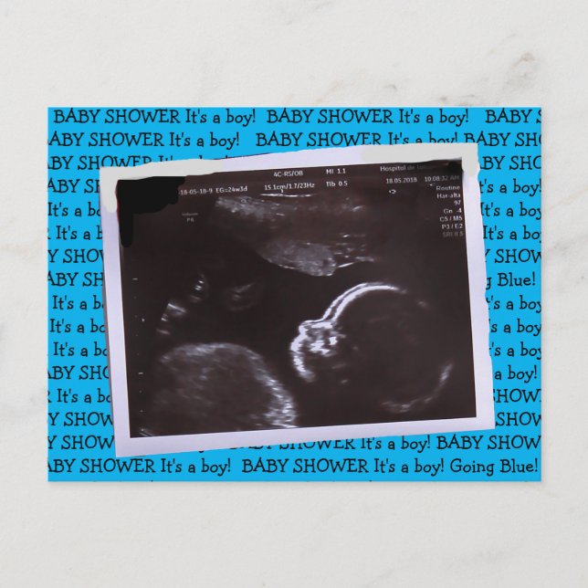 Invitation Baby shower d'images ultrasoniques (Devant)