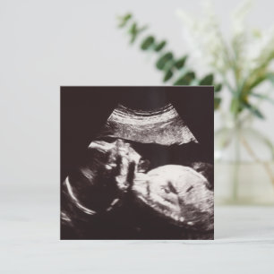 Invitation Baby shower d'images Ultrasound personnalisées