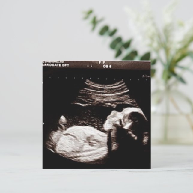 Invitation Baby shower d'images Ultrasound personnalisées (Debout devant)
