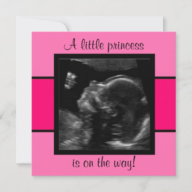 Invitation Princesse Baby Customisée Modèle photo Ultrasound (Devant)