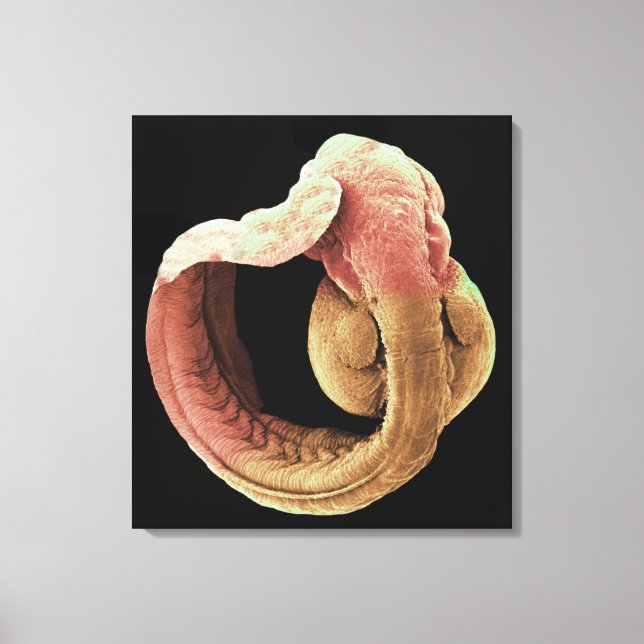 Japanische Medaka Fisch Embryo Leinwanddruck (Vorderseite)