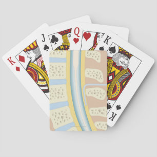 Jeu De Cartes Anesthésie péridurale