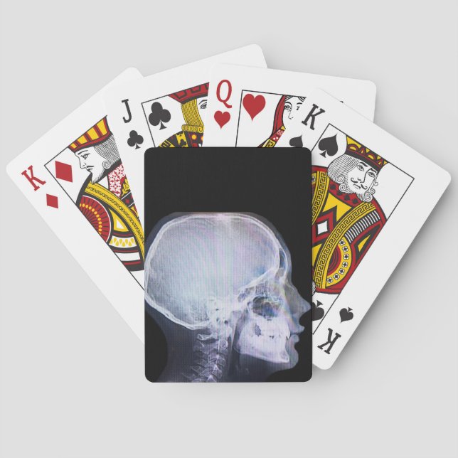 Jeu De Cartes Cartes de jeu de rayon X (dos)