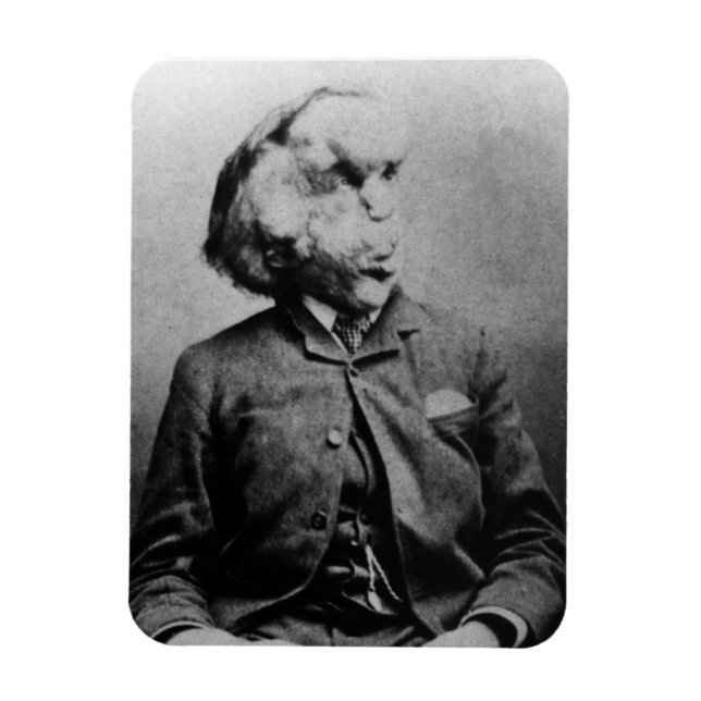 Joseph "John" Merrick Der Elefantenmann von 1889 Magnet (Vertikal)