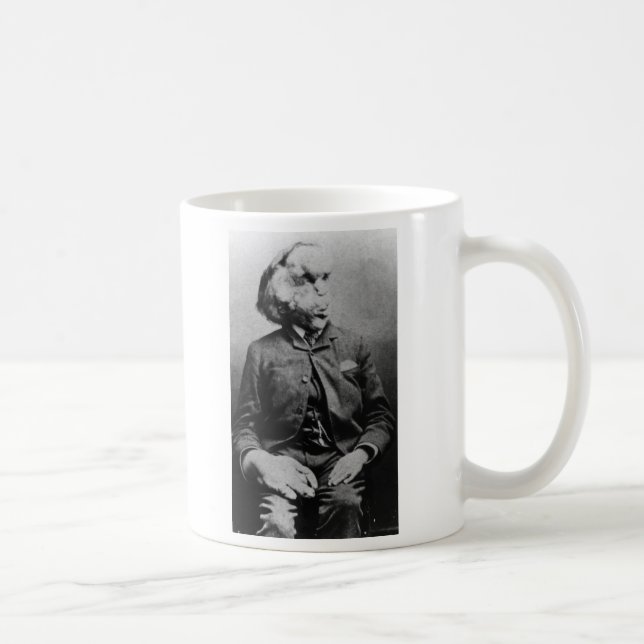 Joseph "John" Merrick Elephant Man ab 1889 Kaffeetasse (Rechts)