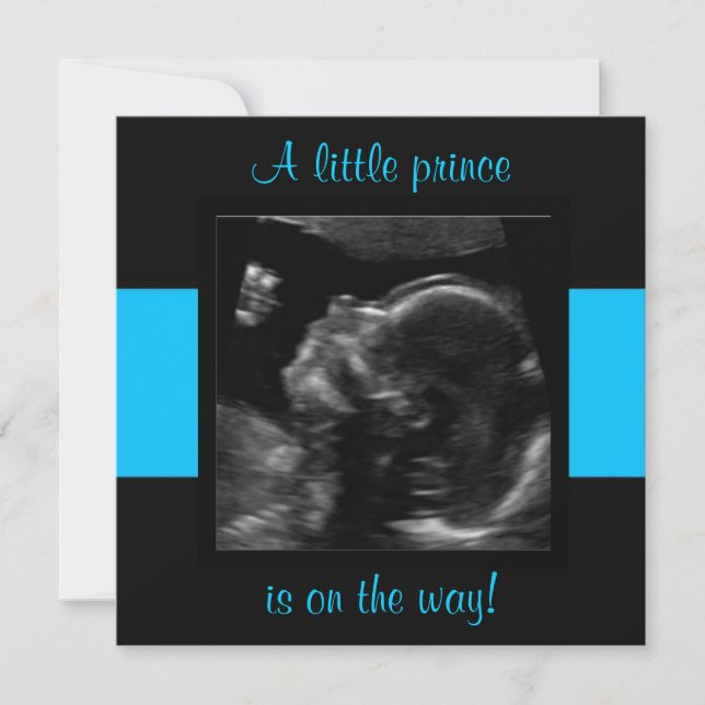 Junge Baby angepasste Ultraschallfoto-Vorlage Einladung (Vorderseite)