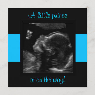 Junge Baby angepasste Ultraschallfoto-Vorlage Einladung