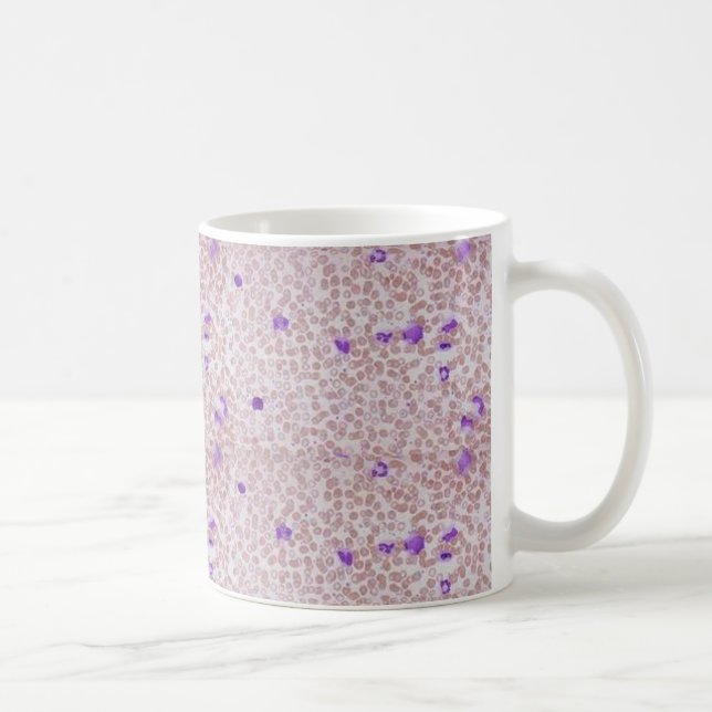 Kaffee-Tasse - chronische Myeloid Leukämie (CML) Kaffeetasse (Rechts)