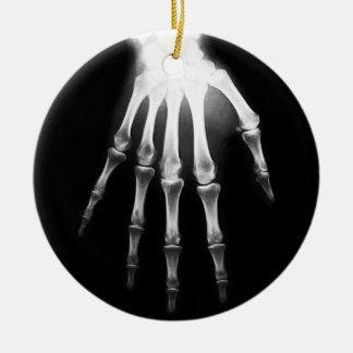 Klinik X-Ray-Handklinik Keramik Ornament