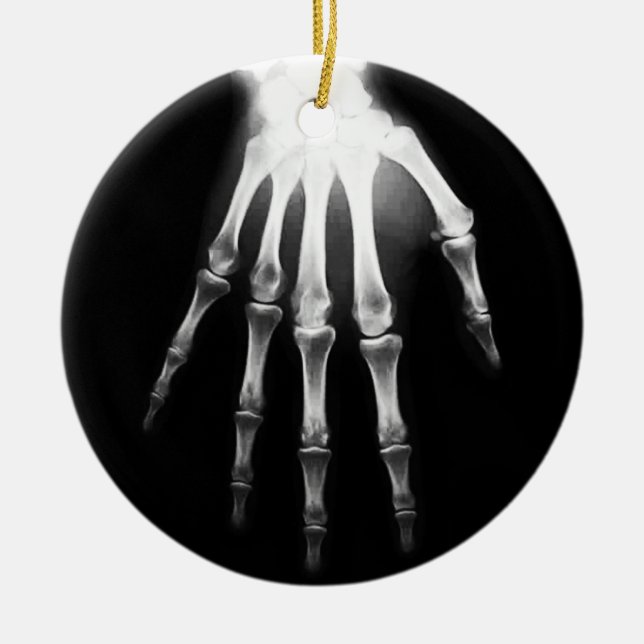 Klinik X-Ray-Handklinik Keramik Ornament (Vorne)
