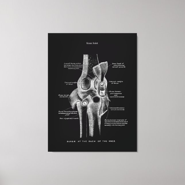 Kniegelenke Anatomie Kunst Leinwanddruck (Vorderseite)