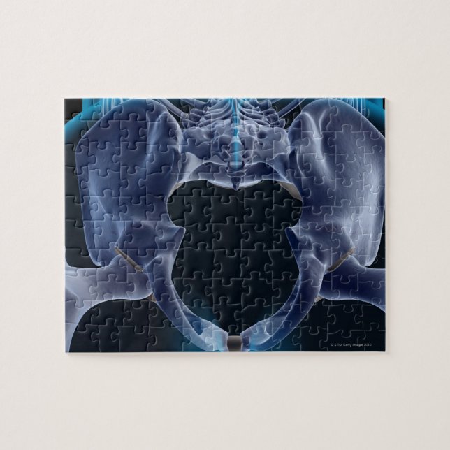 Knochen des Pelvis (Horizontal)