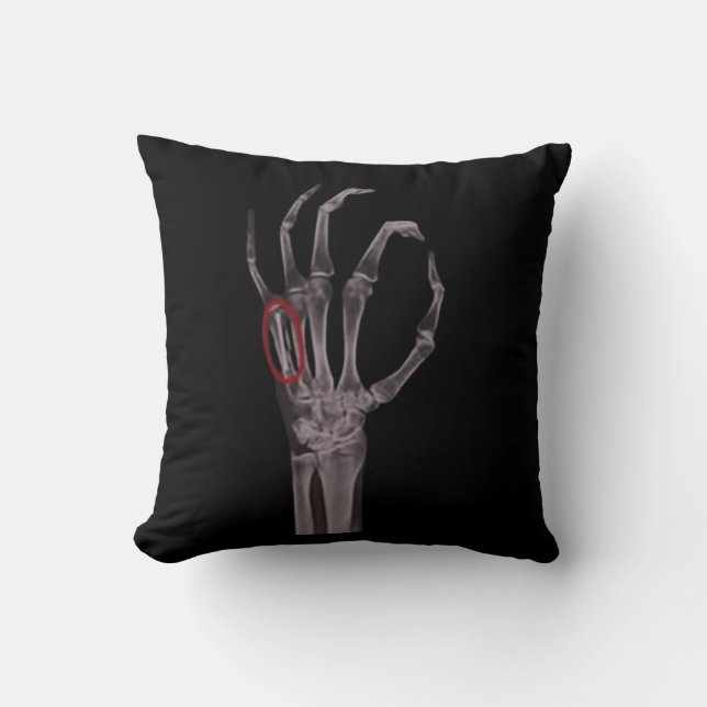 Knochen-Hände Skelett X-RAY-T - Shirt Kissen (Vorderseite)